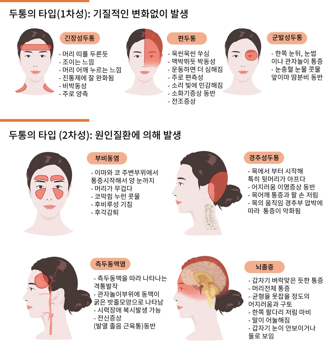 두통을 1차성(긴장성·편두통·군발성)과 2차성(부비동염·경추성·측두동맥염·뇌졸중)으로 나누어 유형별 양상을 정리한 일반 안내 일러스트