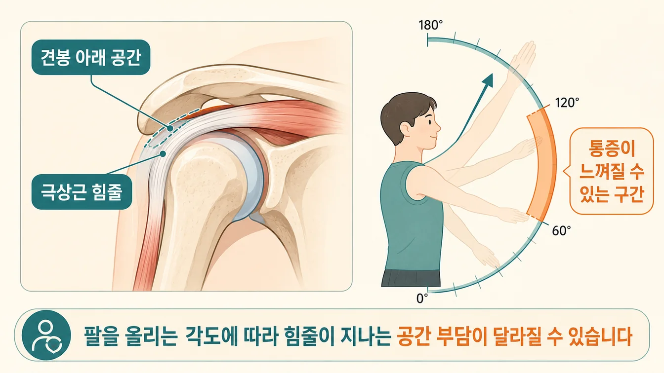 팔을 들어 올릴 때 통증 구간(통증호) 안내