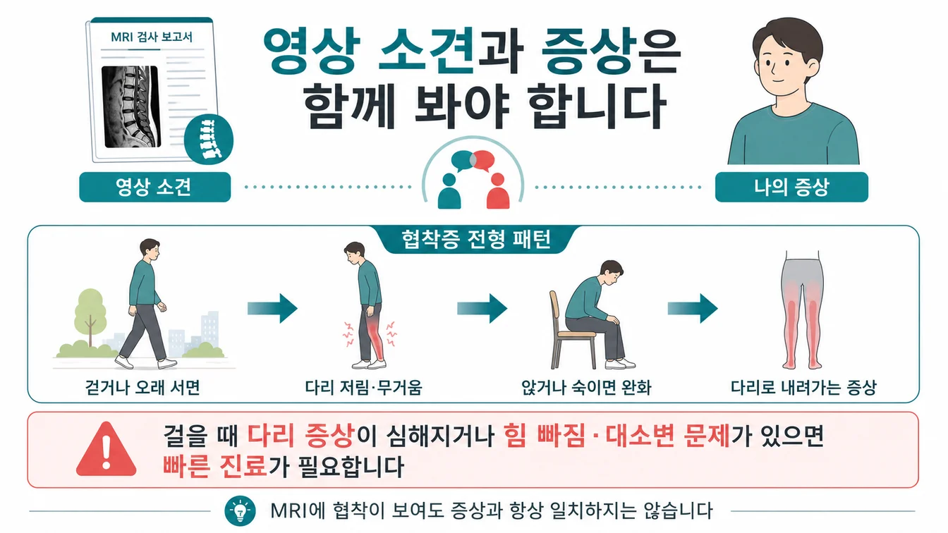 척추 협착의 영상 소견과 실제 증상 패턴 — 걷거나 서면 다리 저림, 앉으면 완화
