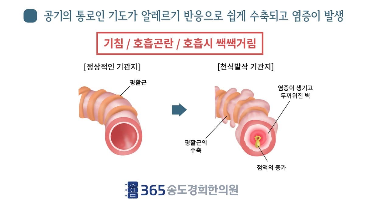 정상·이상 기관지 해부 안내 자료