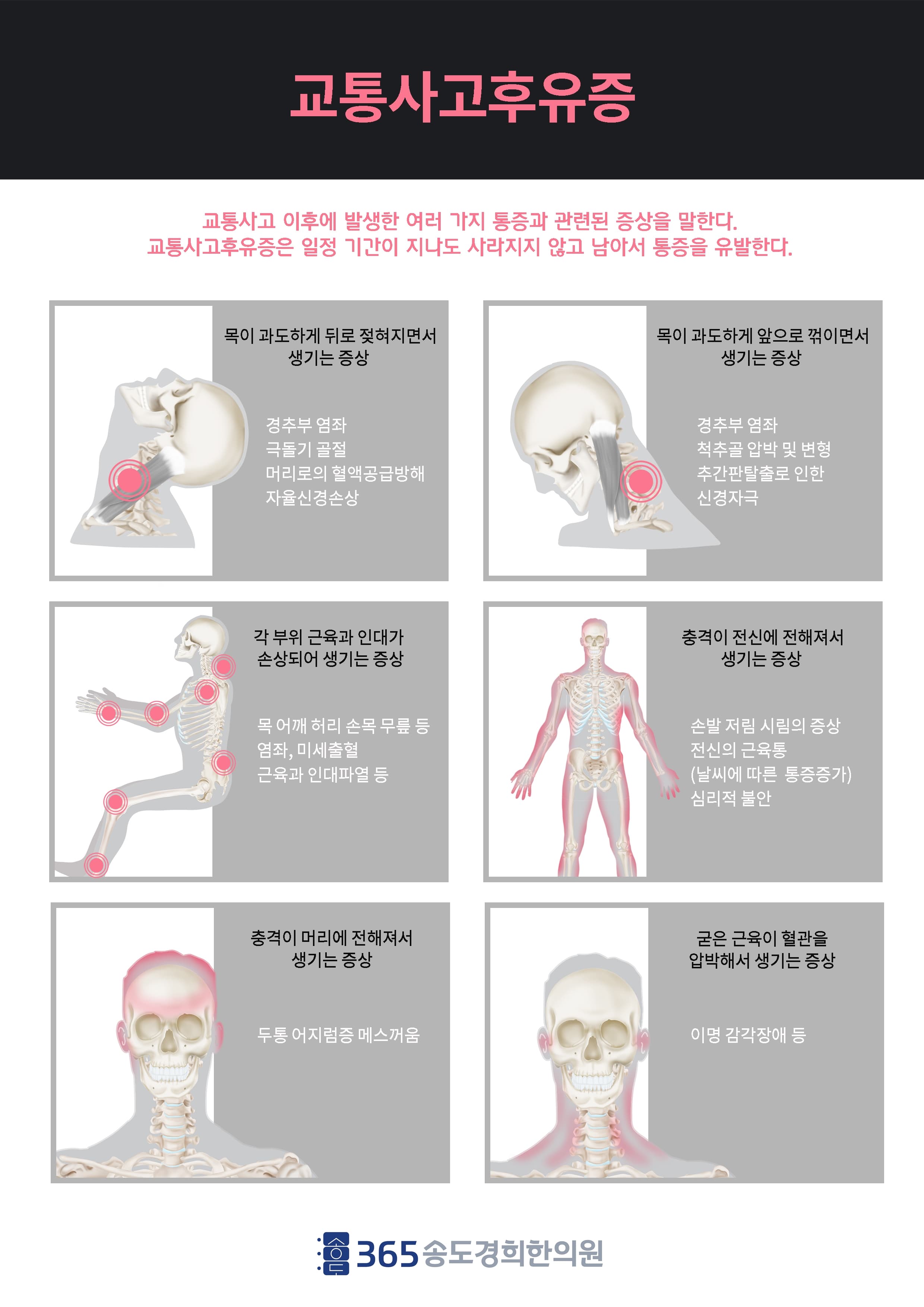 교통사고 후유증 일러스트