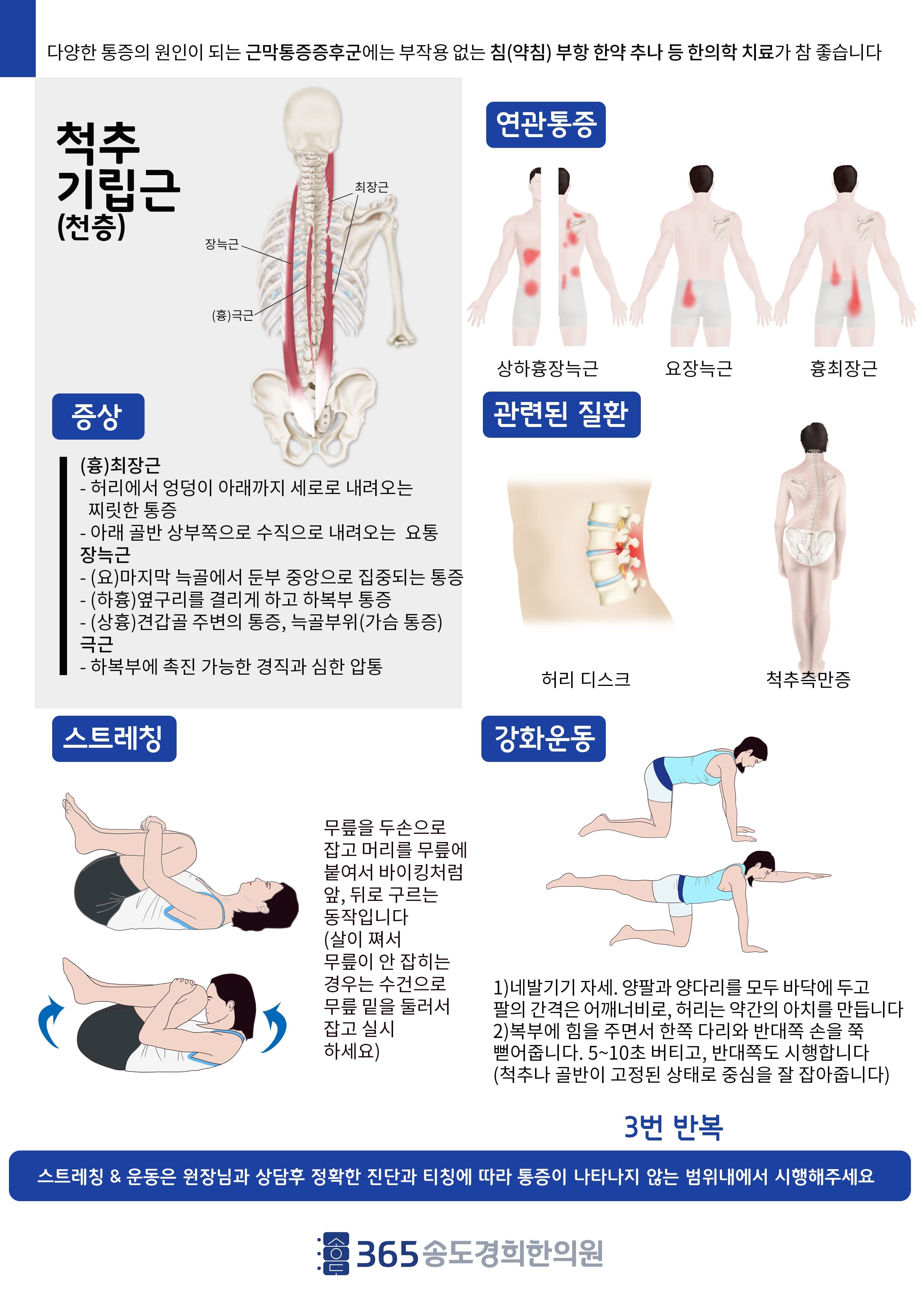 척추기립근 관련 안내 자료