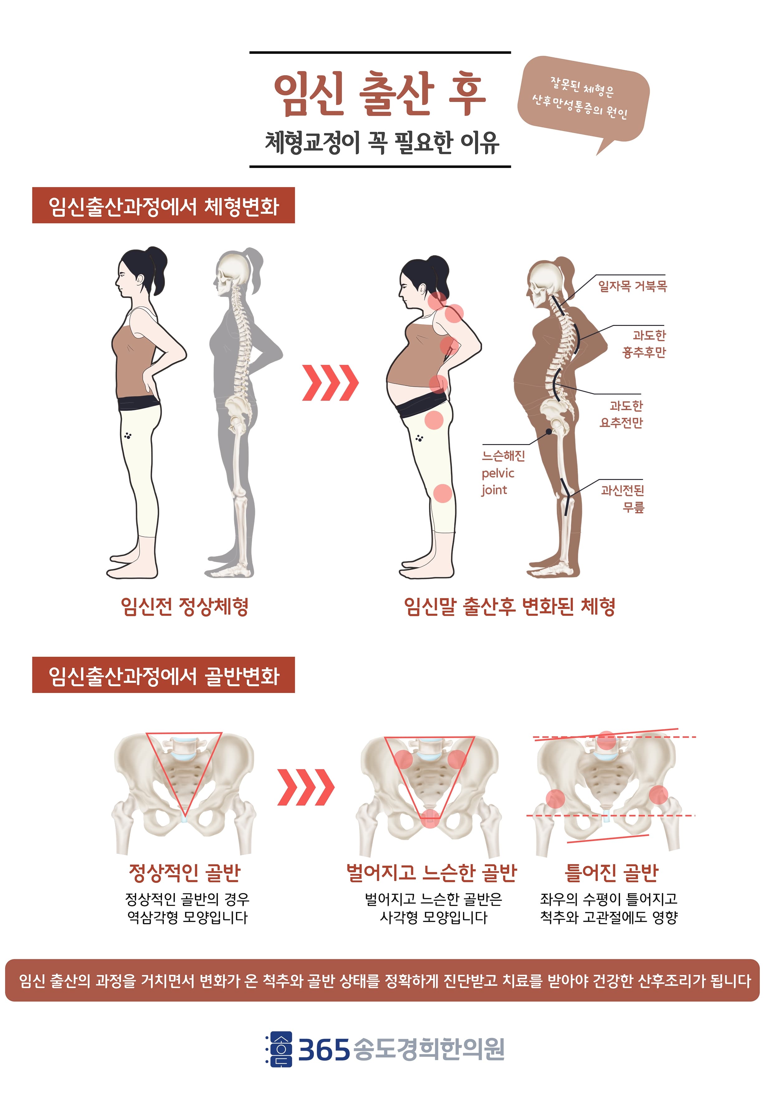 산후 자세·체형 회복 안내 자료