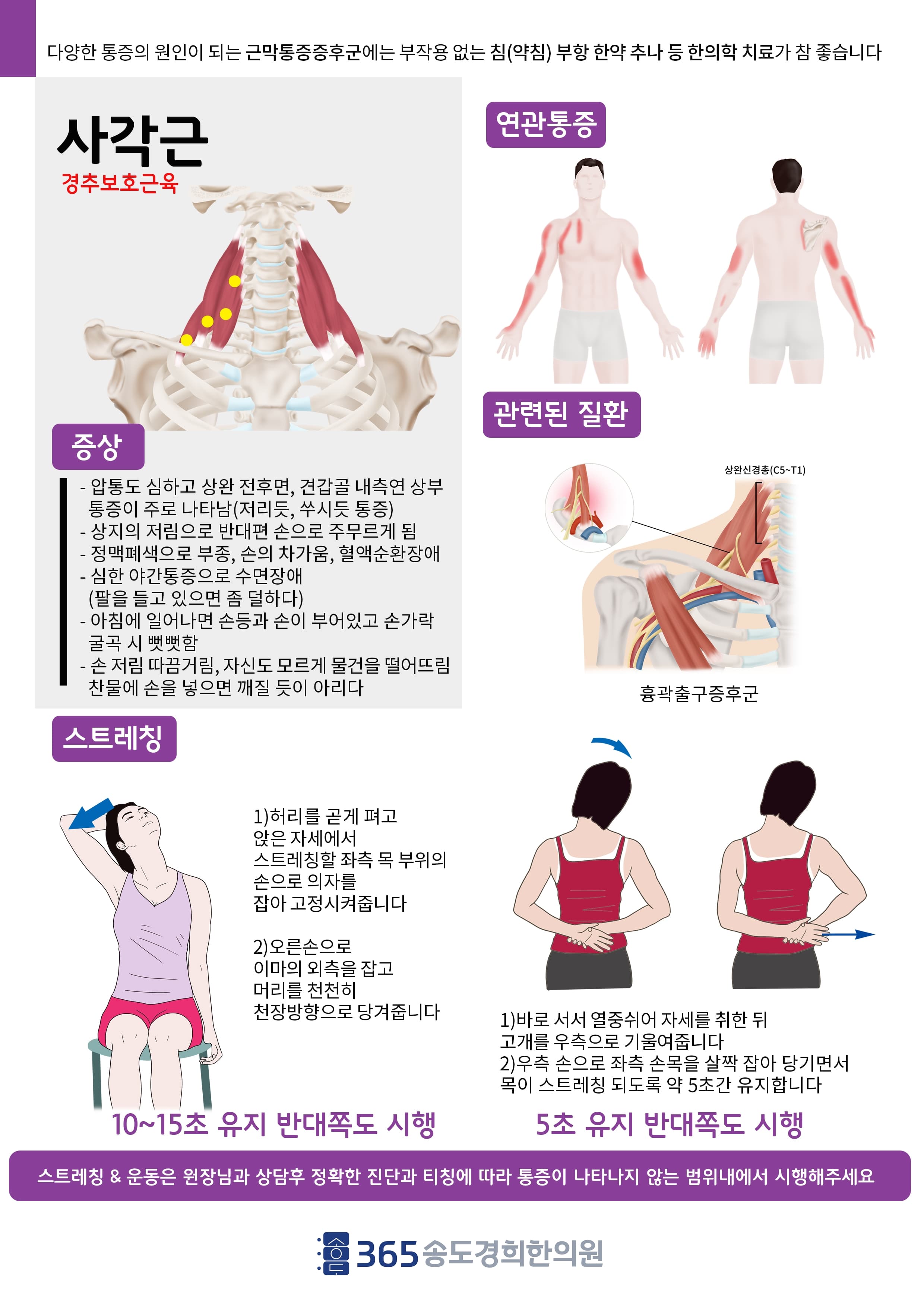 사각근 관련 안내 자료