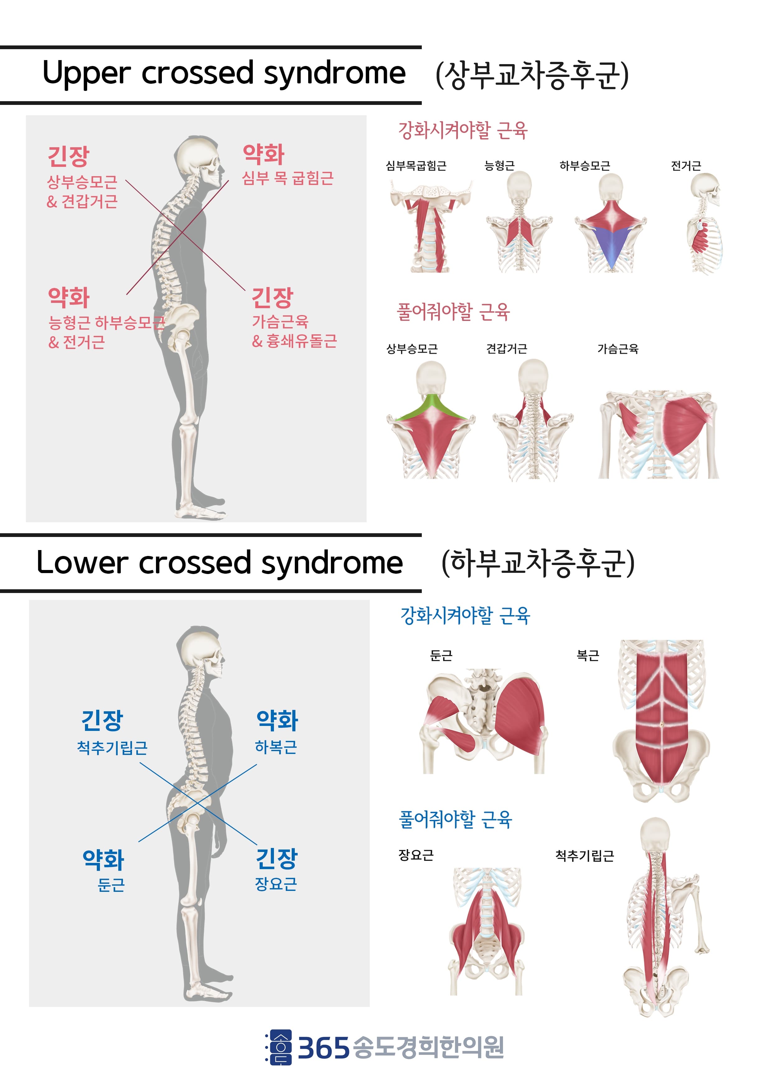 상부교차증후군 안내 자료