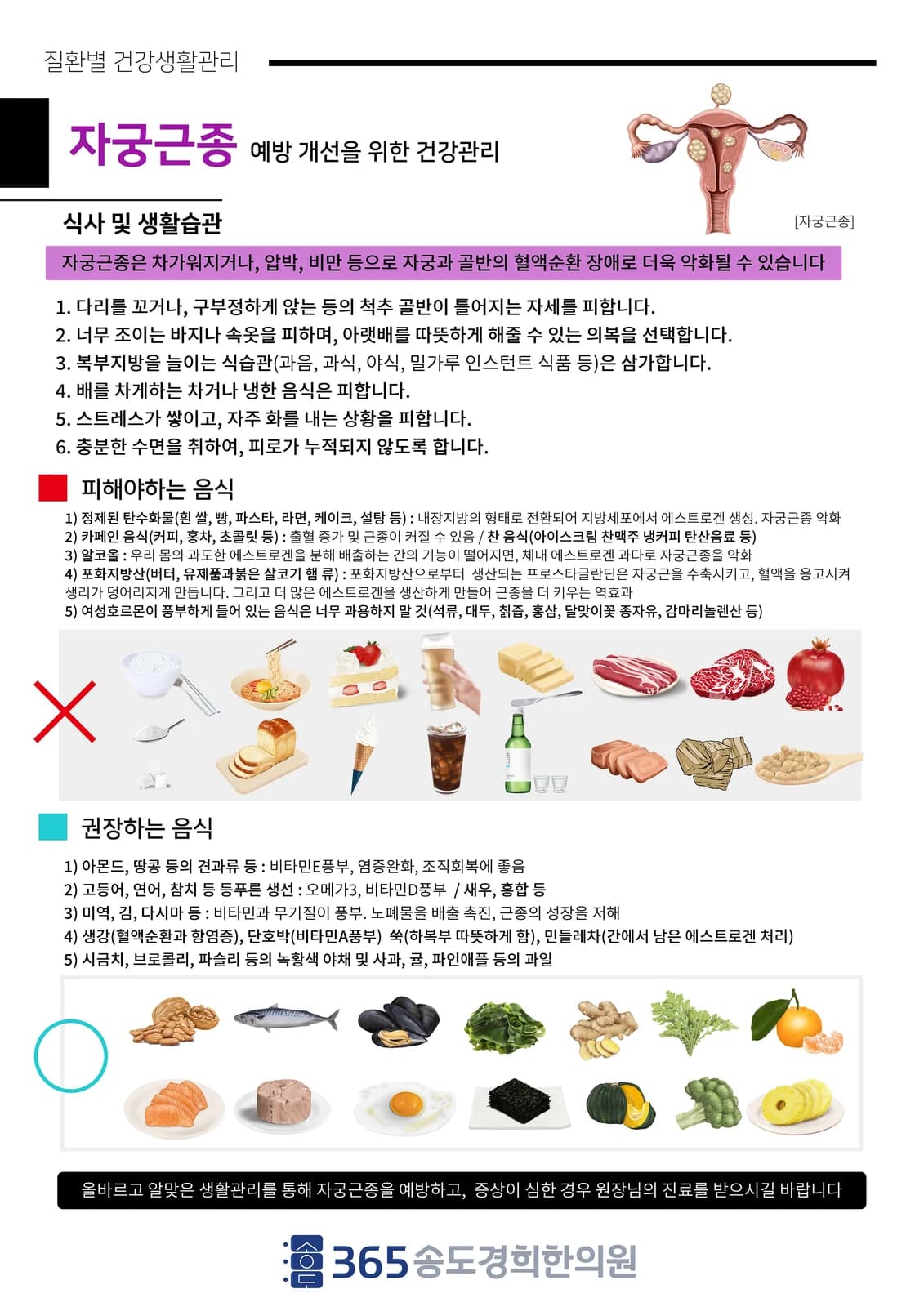 자궁근종 식사·생활관리 안내지