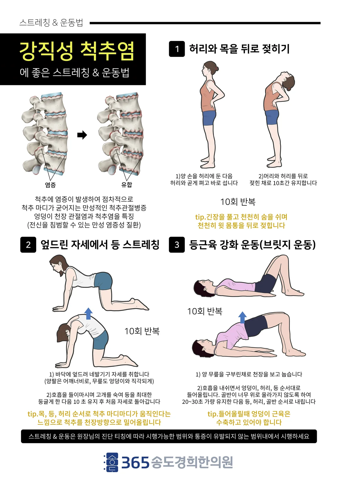 강직성 척추염 관리 운동 안내지