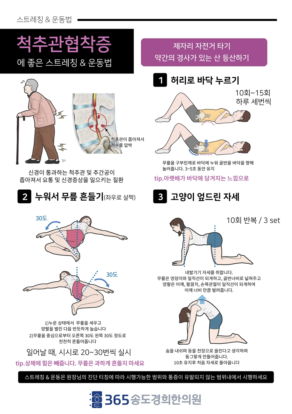 척추관 협착증 안내지