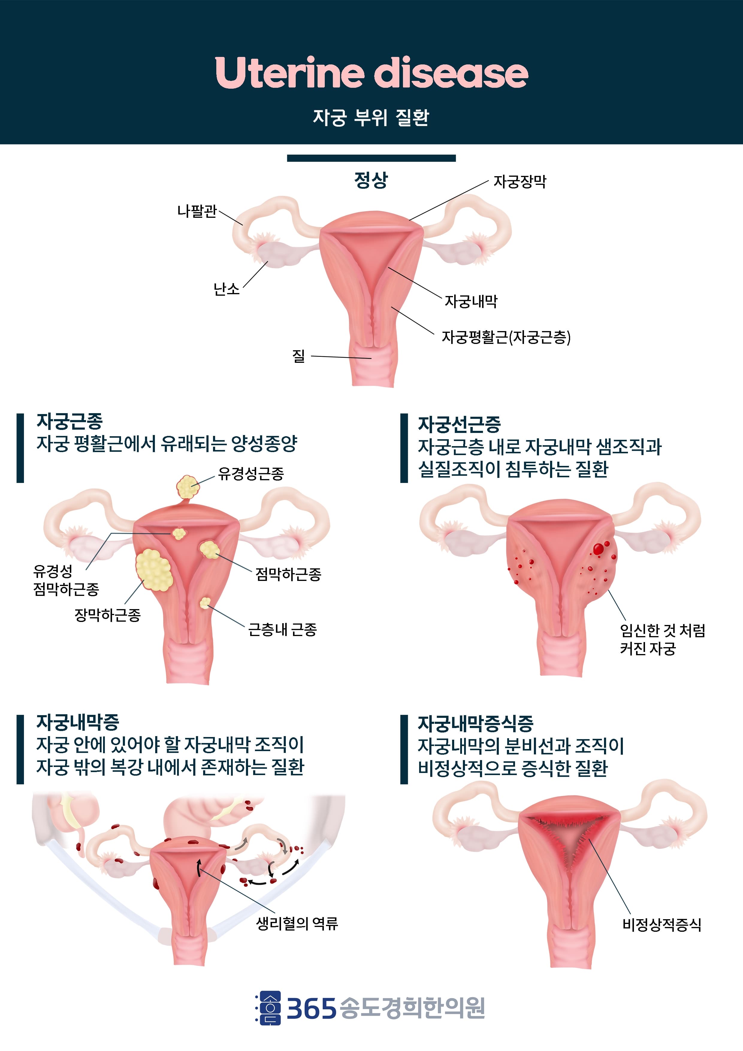 여성 건강 관련 일러스트