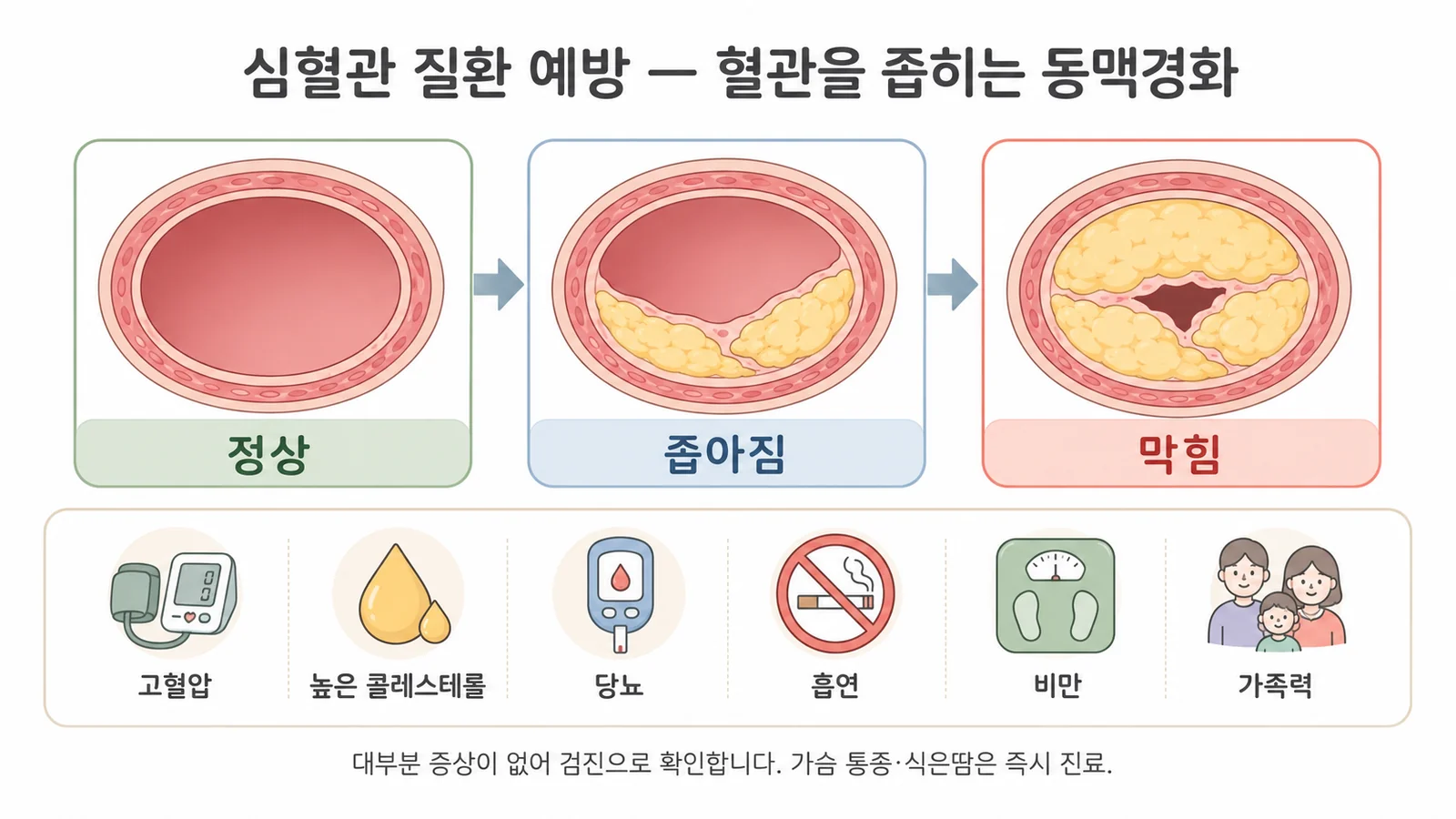 심혈관 질환 예방 — 안내 일러스트