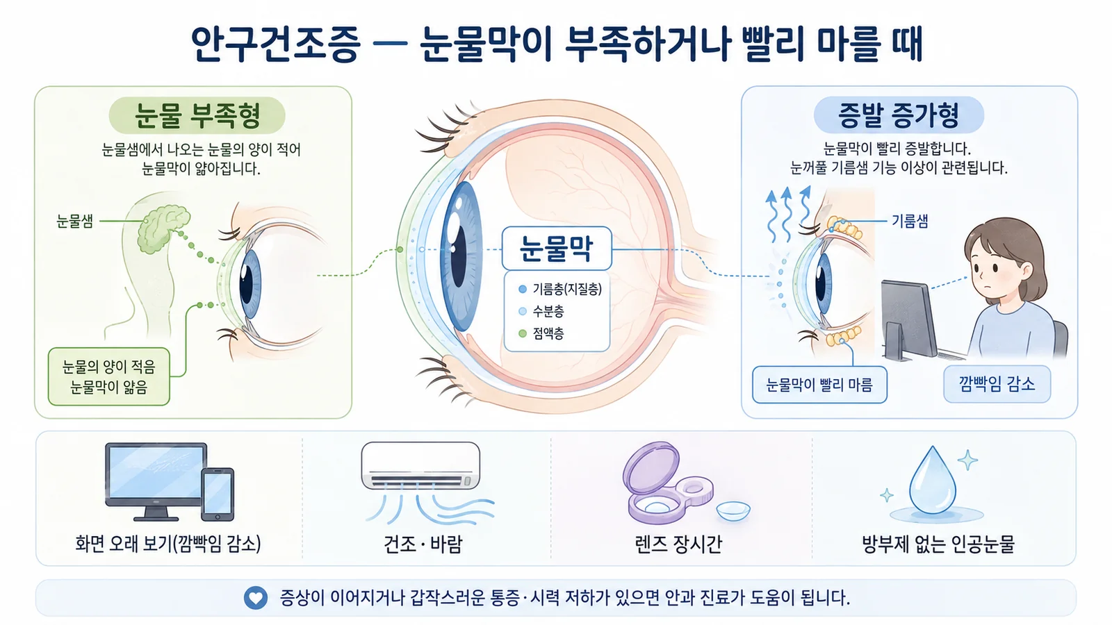 안구건조증 — 안내 일러스트