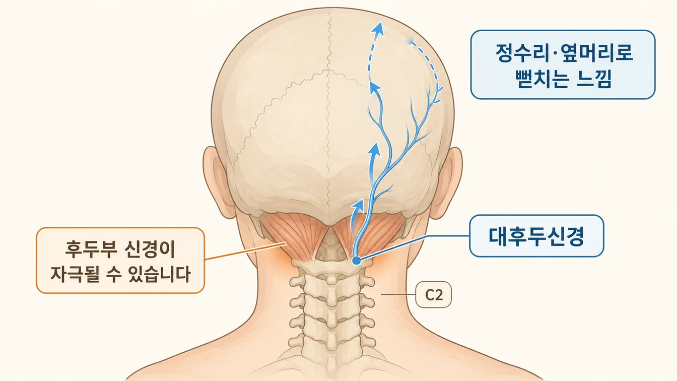 뒤통수 아래에서 정수리 방향으로 이어지는 대후두신경 경로 안내