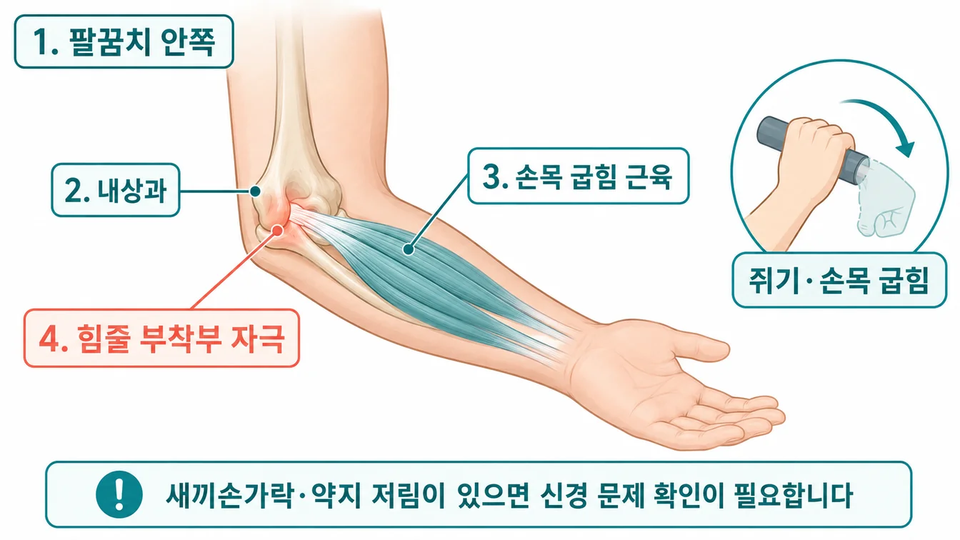 팔꿈치 안쪽 내상과와 손목 굴곡근 부착부를 표현한 한국어 라벨 안내 일러스트