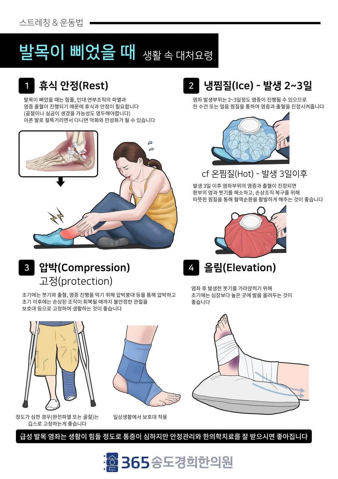 발목 염좌 후 대처요령 안내지