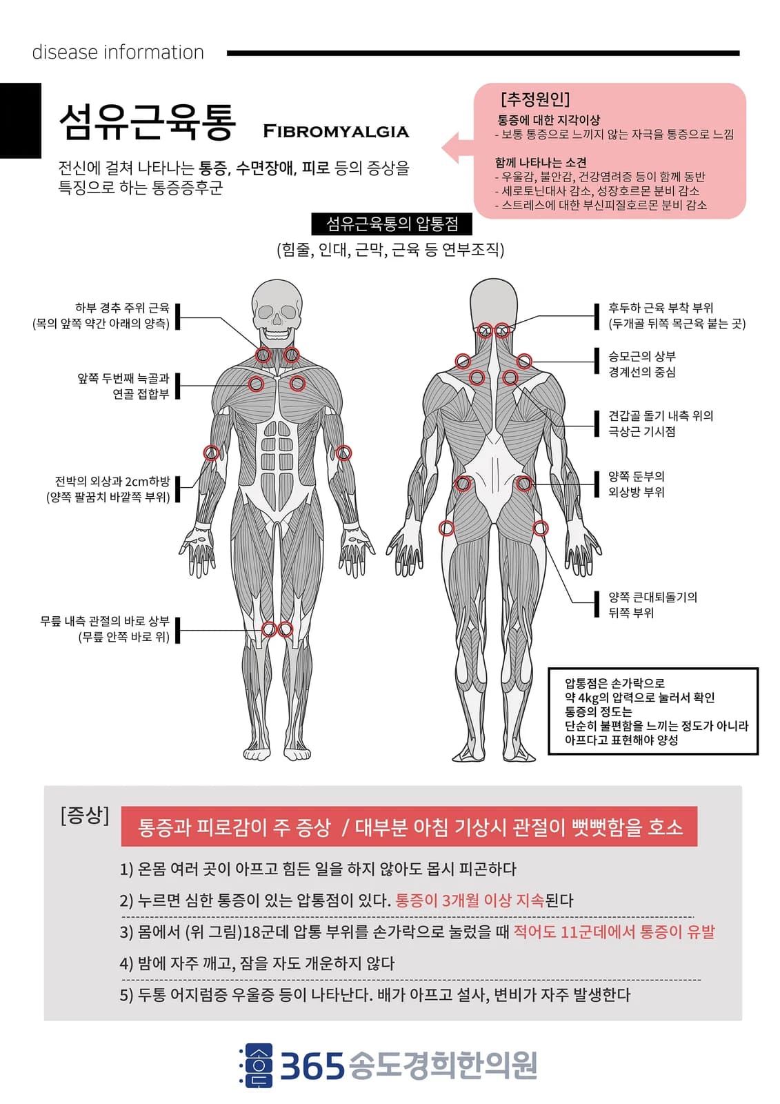 섬유근육통 질환 설명 안내지