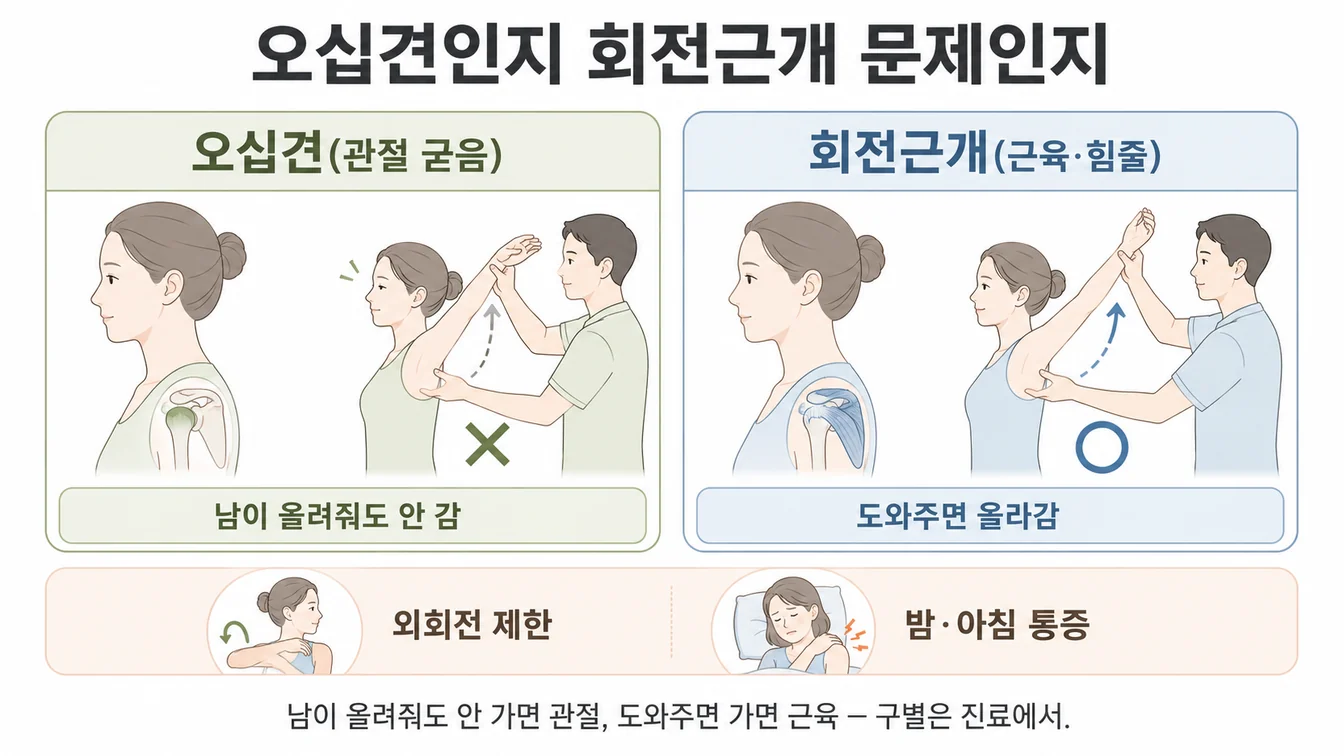 내가 들 때와 남이 들어줄 때의 차이로 오십견과 회전근개 문제를 구별하는 양상 안내