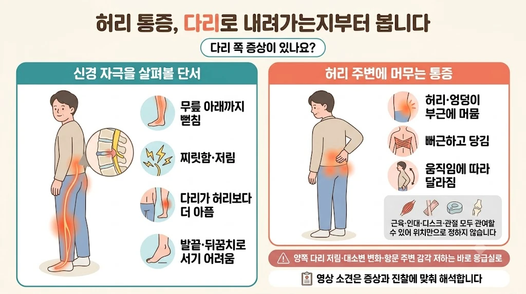허리 통증을 다리 쪽 증상이 있는지로 나눠 본 안내 그림
