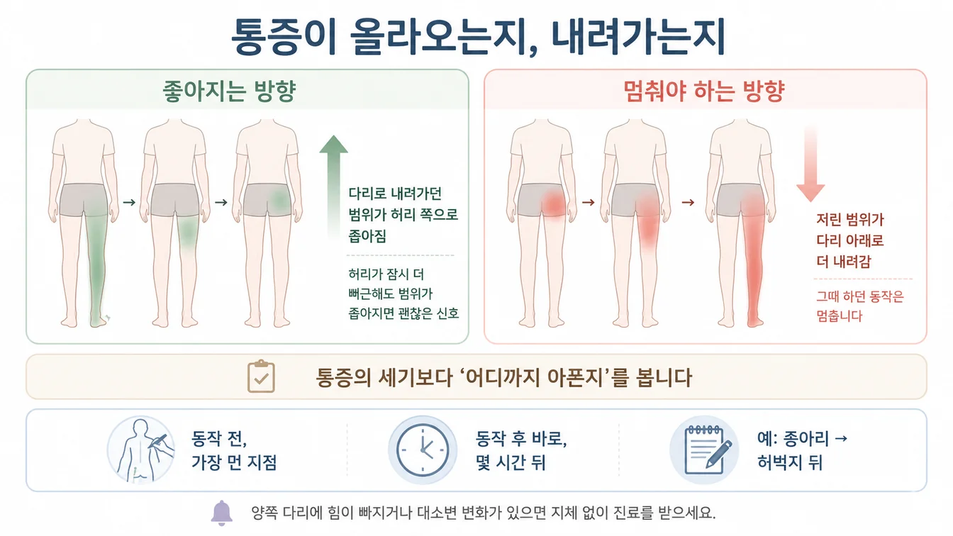 다리로 내려가던 통증이 허리 쪽으로 올라오는 변화와 반대로 더 내려가는 변화를 비교해 보여주는 안내 이미지