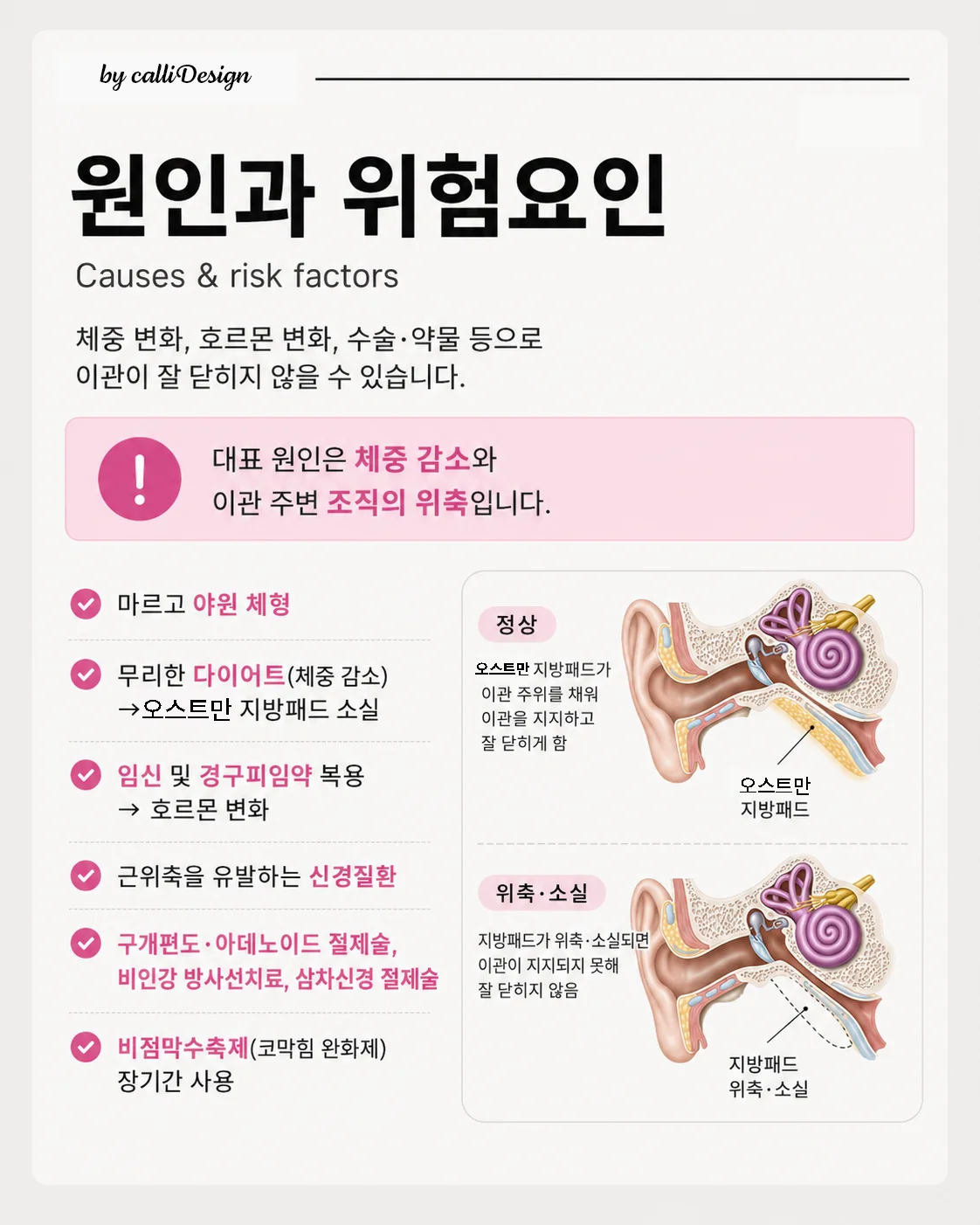 이관개방증의 원인과 위험요인 안내 이미지