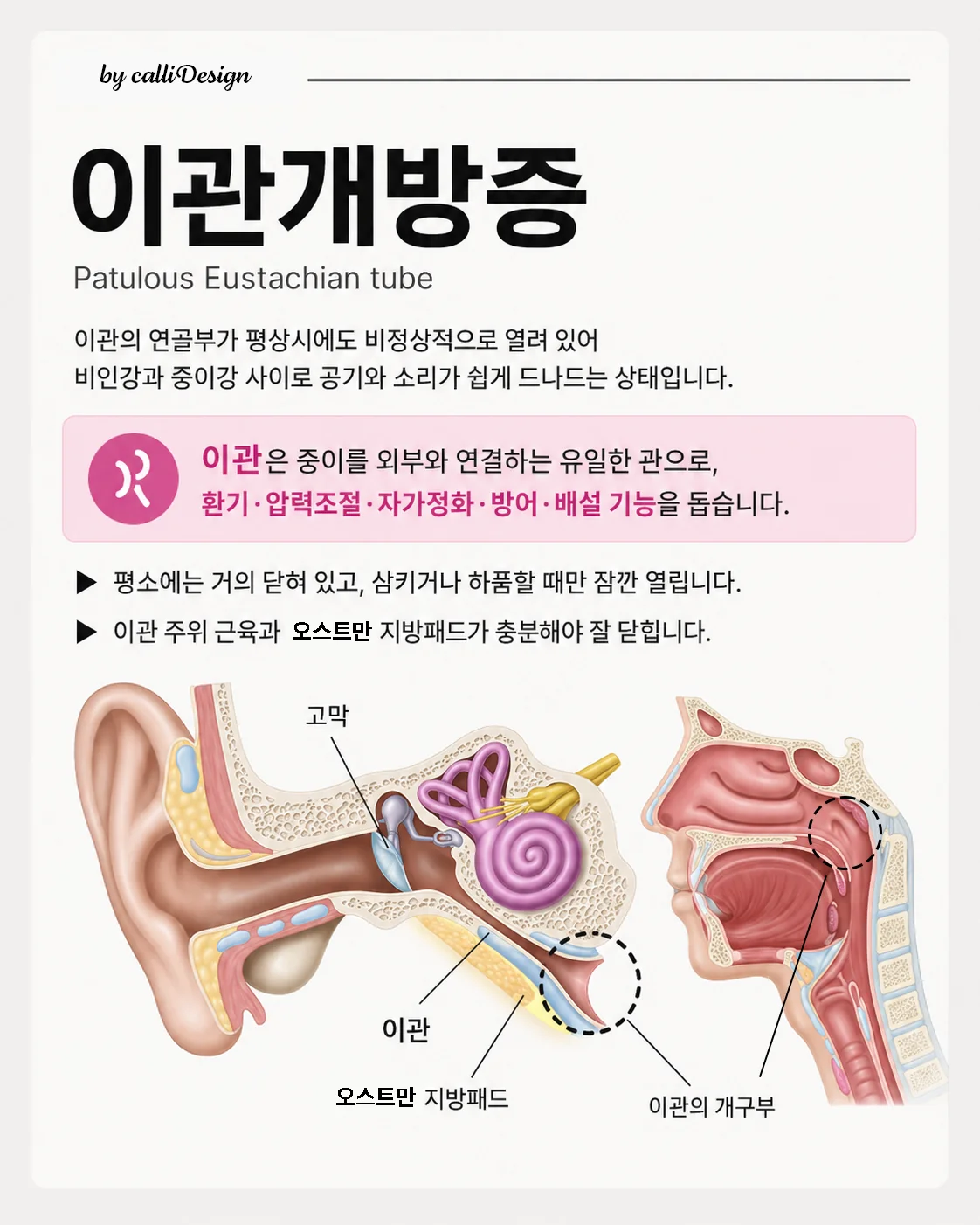 이관의 위치와 역할을 보여주는 귀·비인강 단면 안내 이미지