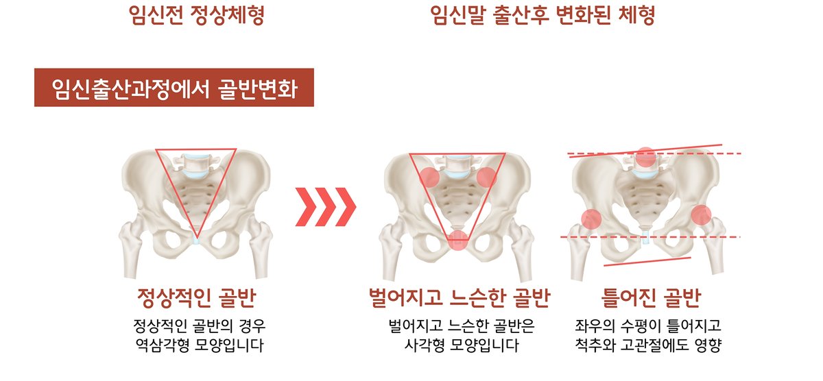 산후 체형·골반 변화 안내 자료