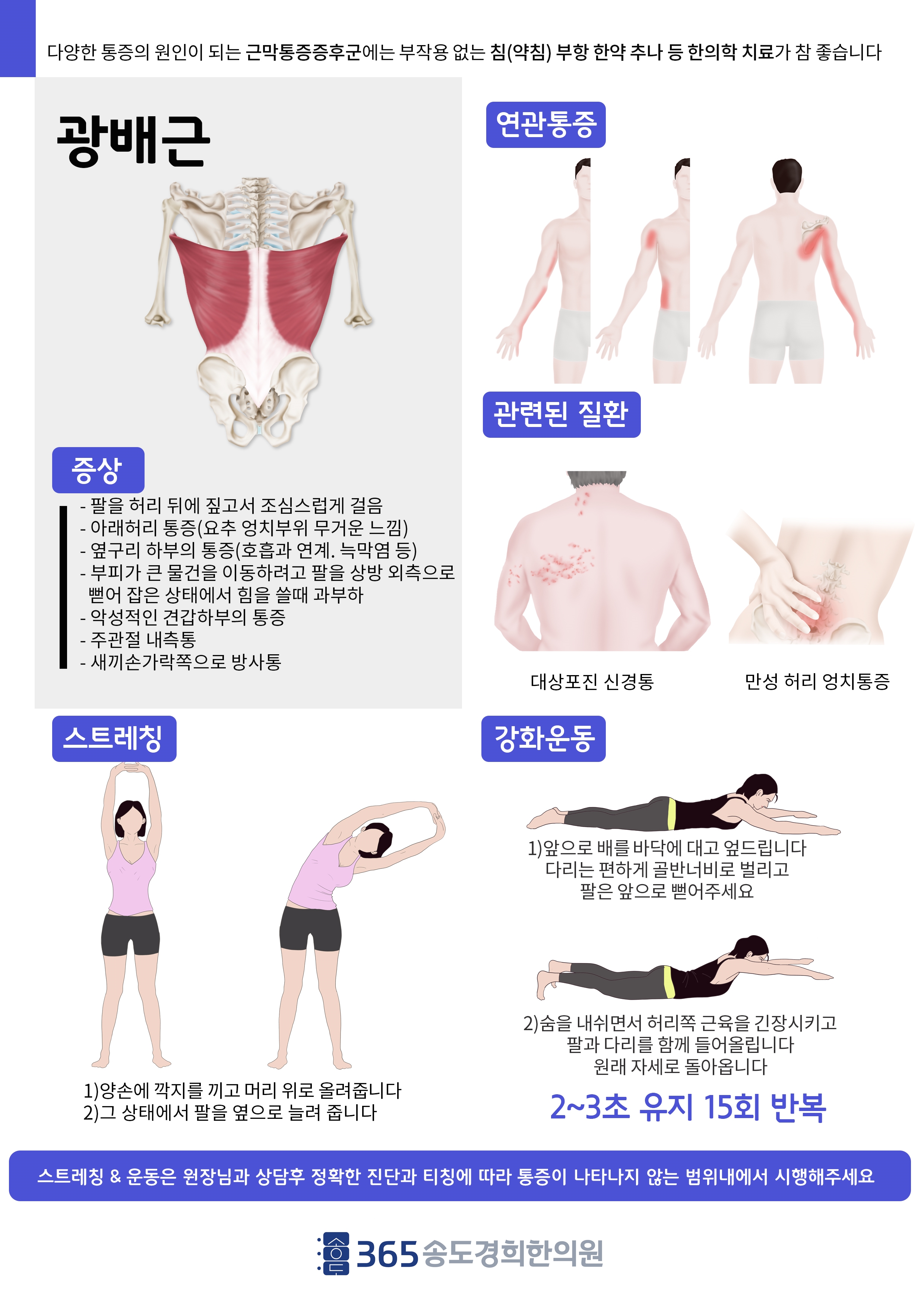 광배근 관련 안내 자료
