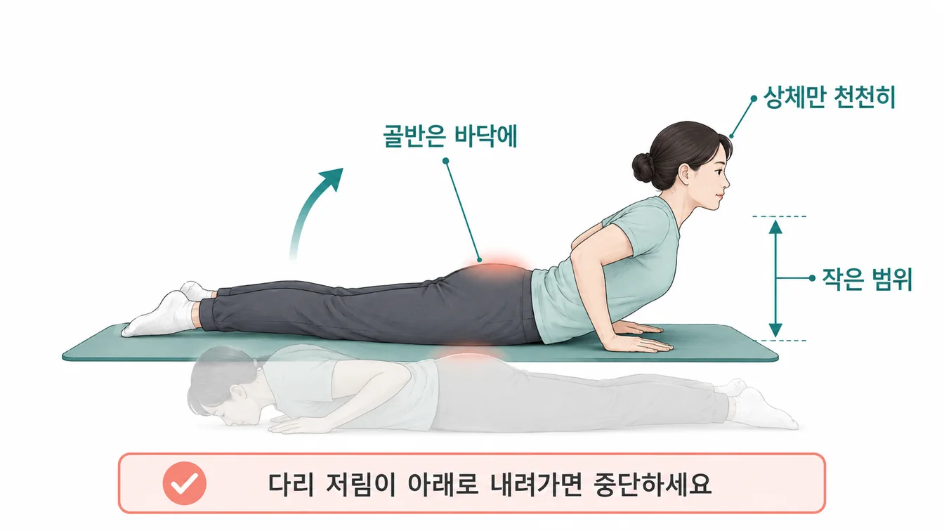 McKenzie Press-up 안내 일러스트