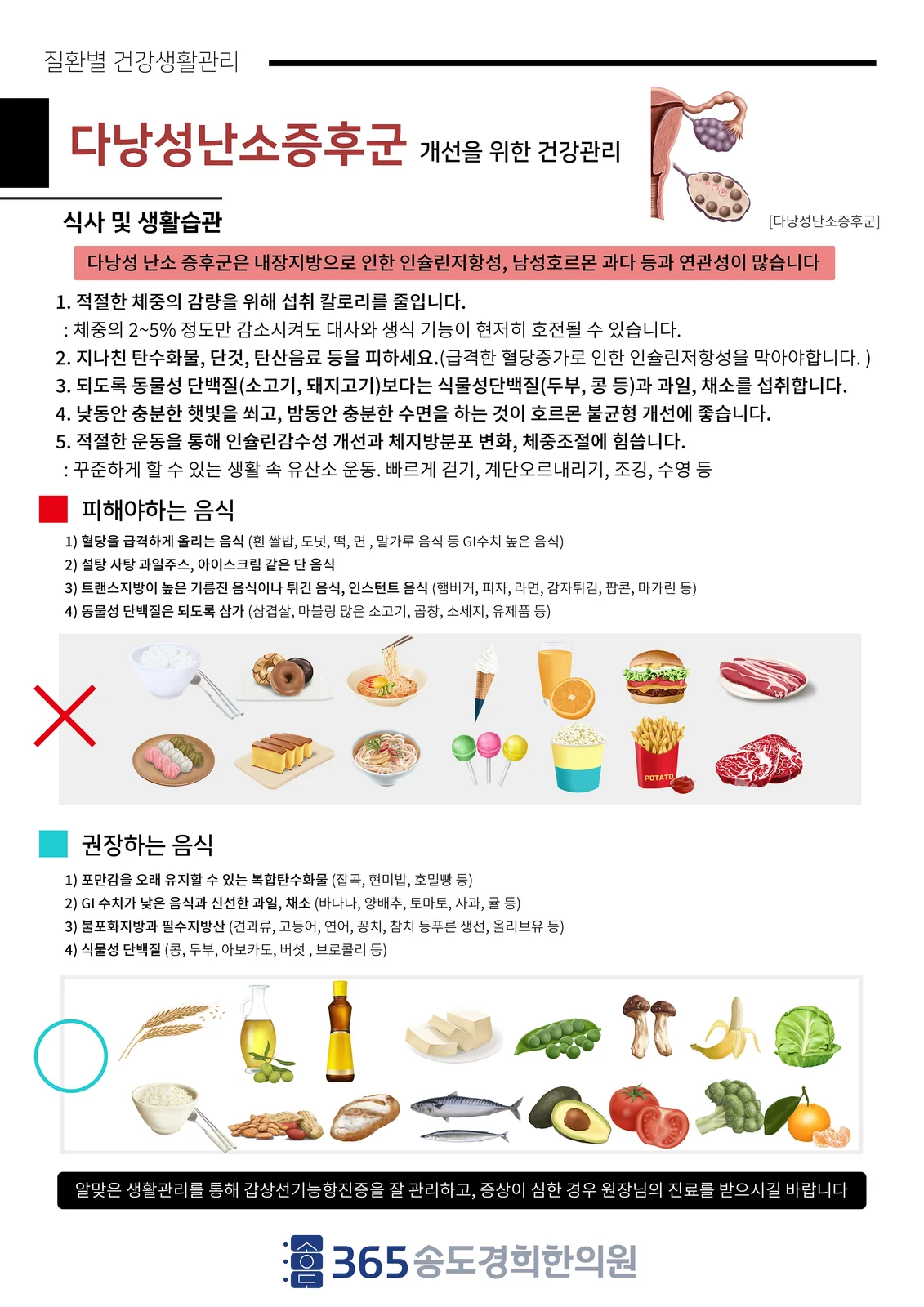 다낭성 난소증후군 개선 식사·생활 안내지